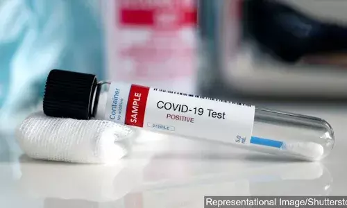ஒரு கோவிட் -19 பரிசோதனையின் போது என்ன நடக்கிறது: இதோ விளக்கம் ஒரு கோவிட் -19 பரிசோதனையின் போது என்ன நடக்கிறது: இதோ விளக்கம்